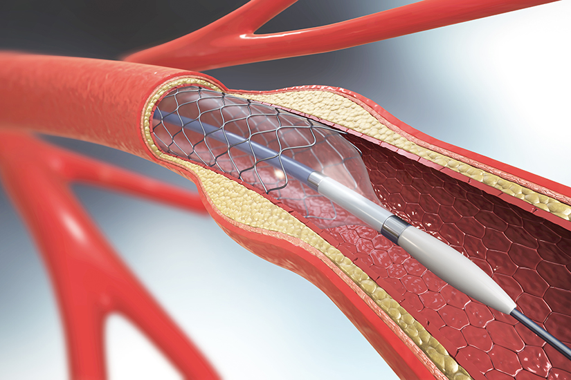 Cardiologie Interventionala Reginamaria Ro