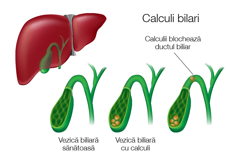 Prost Test Alinia calculi la fiere Asimilare concediere temporară Pescar